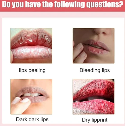 Lip bleaching cream